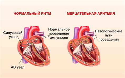 Виды сердечных капель: полное описание и выбор