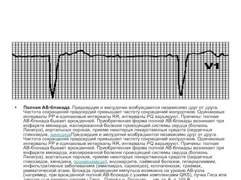 Выбор оптимальных сердечных капель при инфаркте