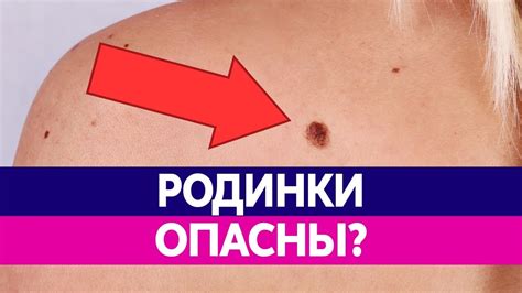Значение родинки на ключице