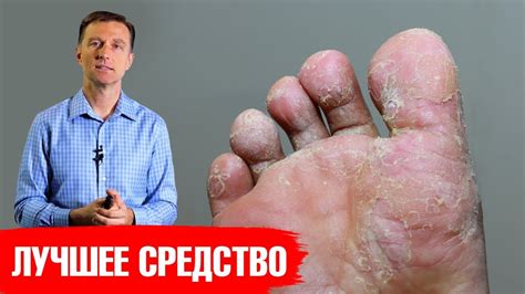 Лечение желтеющих стоп