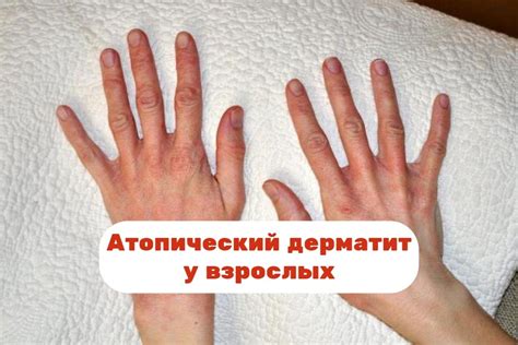 Причины желтения стоп у взрослых