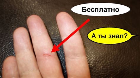 Сон о вздувшемся пальце на руке