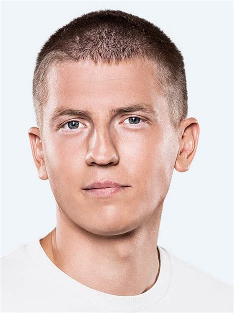 Алексей Щербаков: аномальное развитие носа