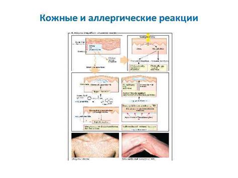 Аллергические реакции и кожные оболочки
