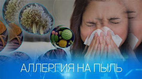 Аллергия или реакция на пыль
