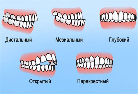 Аномалии роста