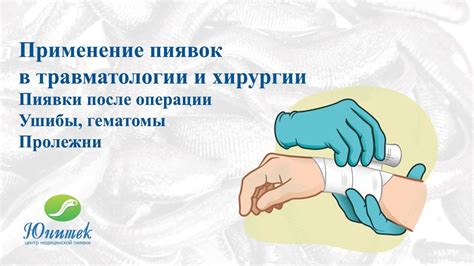 Безопасность применения пиявок при повышенной температуре
