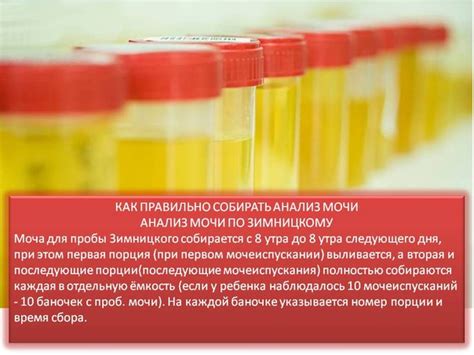Бесполезные попытки сдать мочу без сна