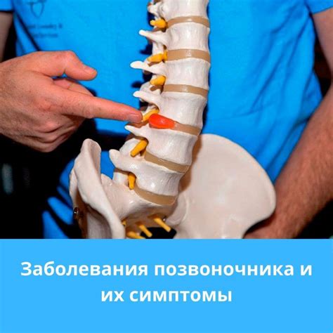Болезни позвоночника: основные проблемы и методы лечения