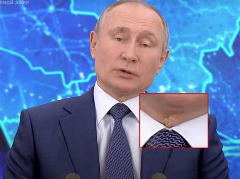 Версии о происхождении шрама и их опровергание