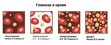 Влияние Карсила на уровень глюкозы в крови