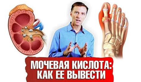 Влияние лимонной кислоты на уровень мочевой кислоты