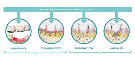 Влияние на костную систему и здоровые зубы