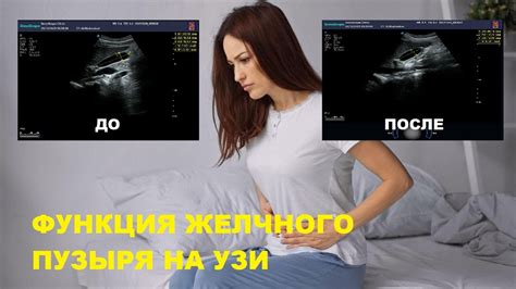 Влияние овса на двигательную функцию желчного пузыря