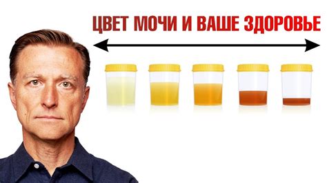 Влияние пигментов на цвет мочи