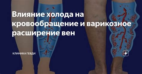 Влияние холода на кровообращение в ягодицах