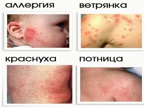 Влияние частого мытья на кожу ребенка