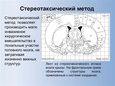 Вмешательство нервной системы