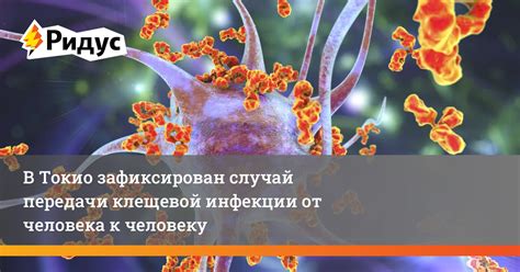 Возможность передачи энцефалита от человека к человеку