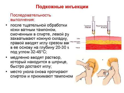 Возможные осложнения после введения спицы в нос