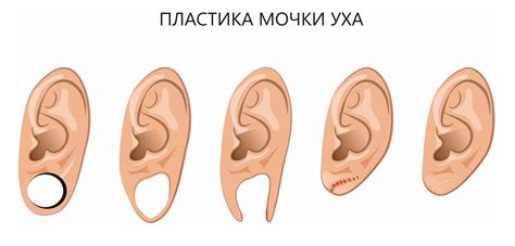 Возможные осложнения при кровотечении из мочки уха