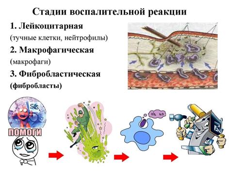 Воспалительные процессы в вымени