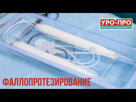Восстановление эректильной функции