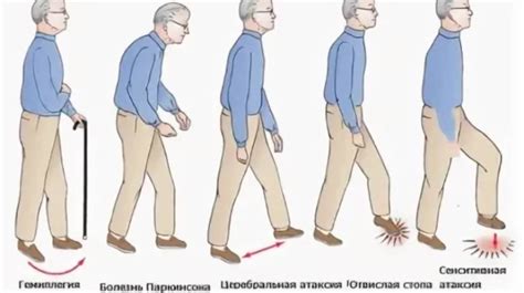Восьмая причина - нарушение координации движений