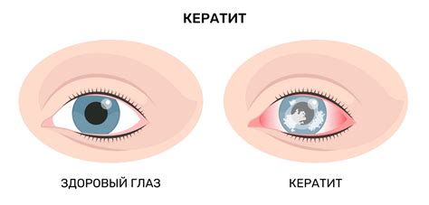Глазные инфекции как причина опухания глаз у Нормана Ридуса