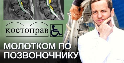 Действенность метода "молотком по позвоночнику" в лечении
