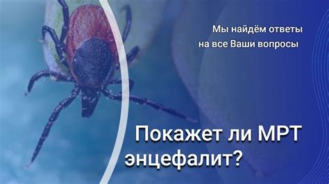 Диагностика энцефалита