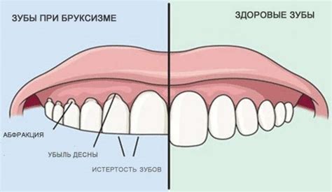 Значение прикусывания языка во сне