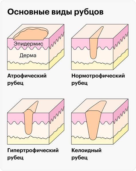 Значение шрама