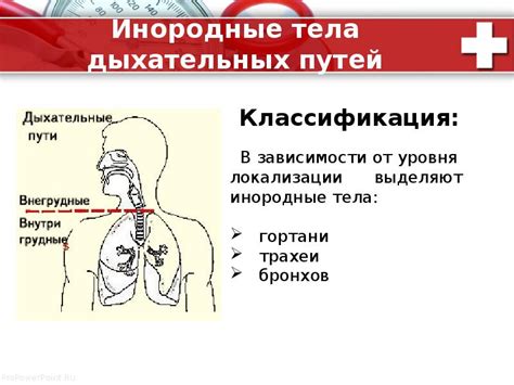 Инородное тело в дыхательных путях