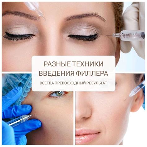 Как работает процедура введения спицы в нос