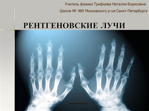 Как стекло воздействует на рентгеновские лучи