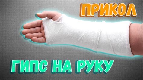 Когда снять гипс с руки: определение момента