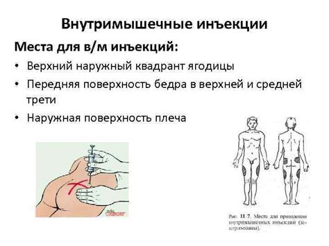 Медицинские показания для введения спицы