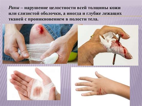 Механические повреждения сосков