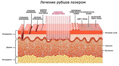 Минимизация риска развития рубцов и шрамов
