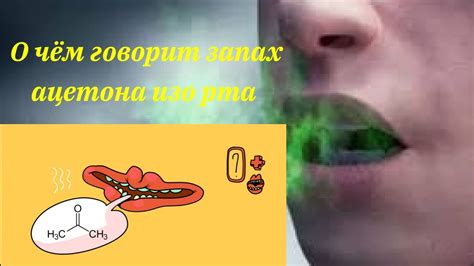 Мифы и правда о пене изо рта при смерти