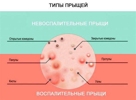 Можно ли получить прыщи от мильгаммы в уколах