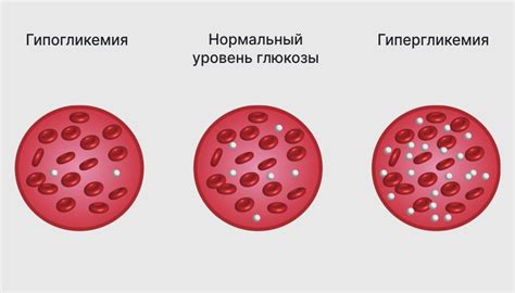 Недостаток полинезированности