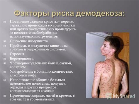 Некоторые дети причмокают во время сна из-за недостаточной обработки пищи