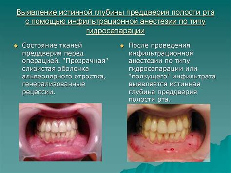 Некоторые разновидности и особенности проведения по лицу