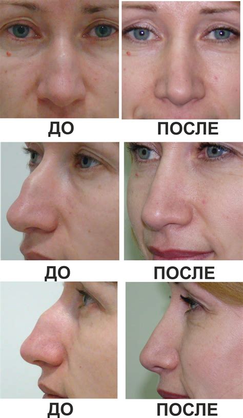 Несексуальные причины касания носа