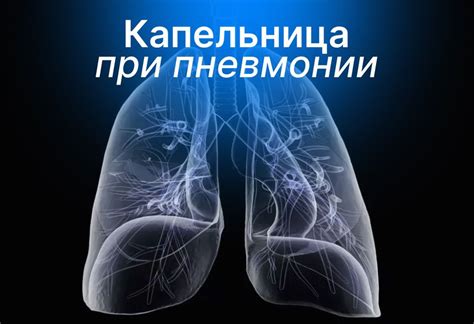Особенности гигиены при пневмонии взрослого