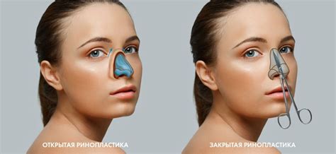 Особенности кожи на кончике носа