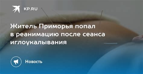 Особенности сеанса после иглоукалывания