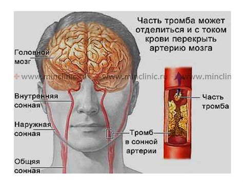 От нарушения кровообращения